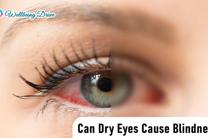 Can Dry Eyes Cause Blindness? Risks, Symptoms & What to Know