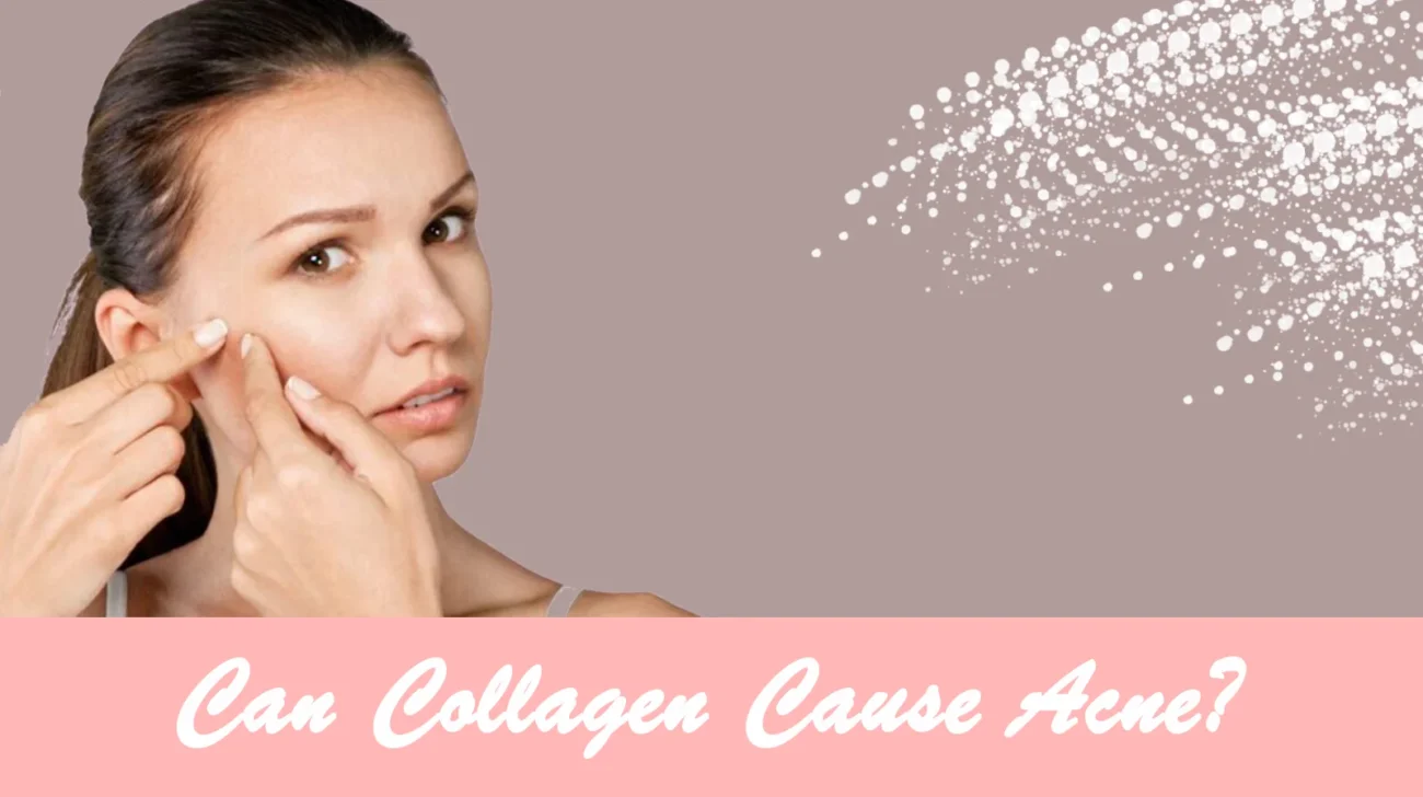 can collagen cause acne