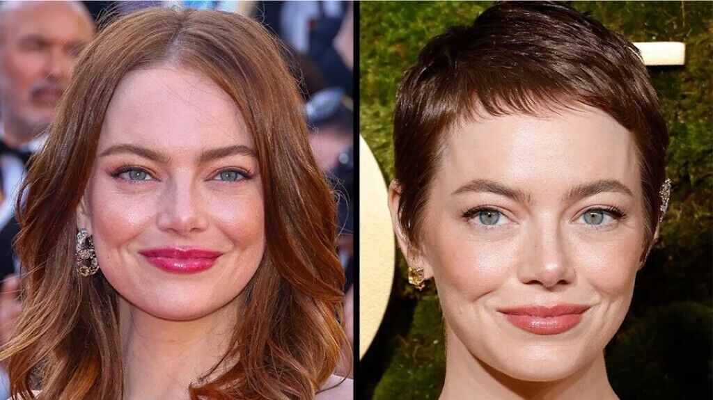 Emma Stone Plastic Surgery Talks