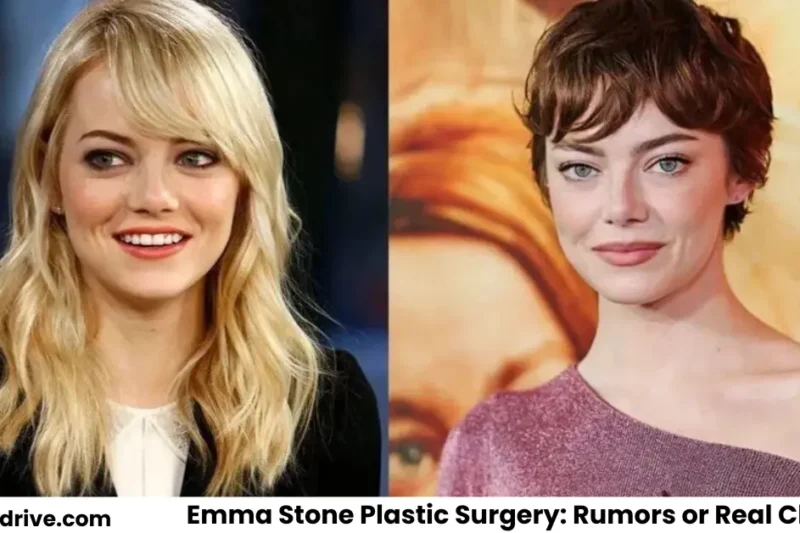 Emma Stone Plastic Surgery and Beauty Evolution