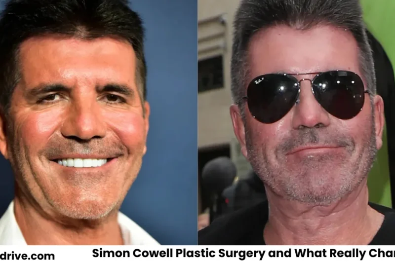 Simon Cowell Plastic Surgery and What Really Changed