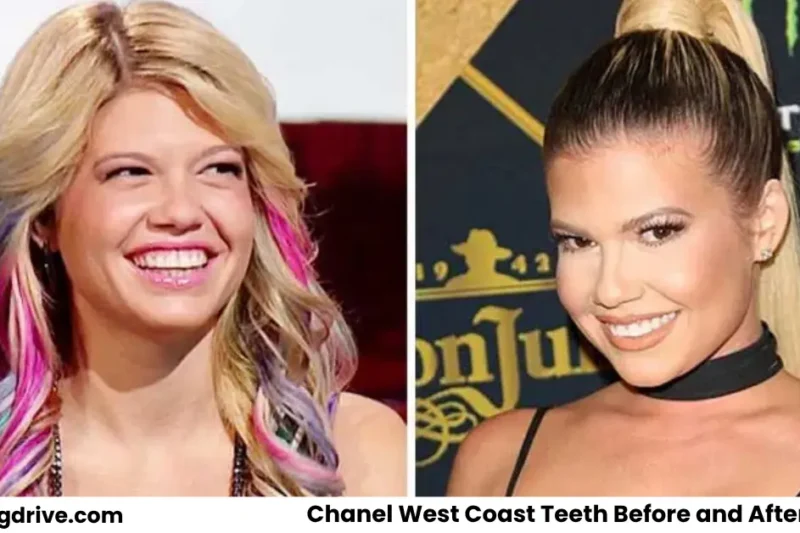 Chanel West Coast Teeth Before Surgery 2021: The Smile Change Explained