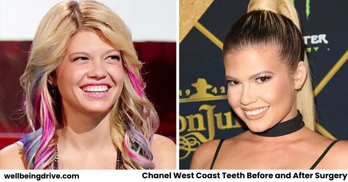 Chanel West Coast Teeth Before and Afteer Surgery