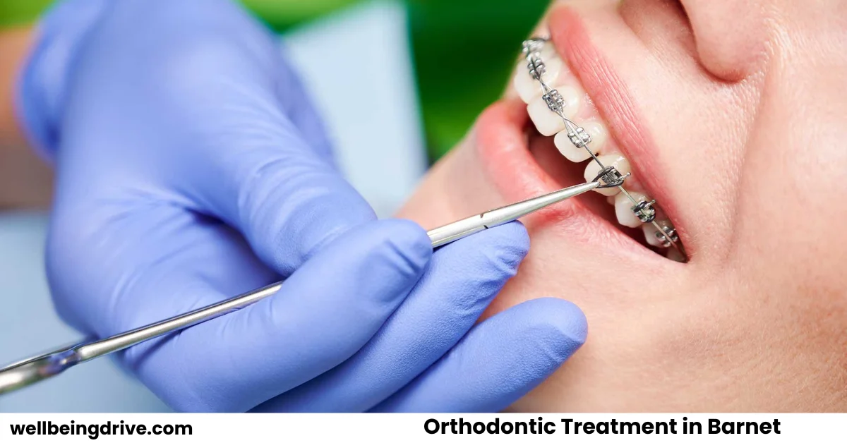 Orthodontic Treatment in Barnet 5 Top Clinics in 2026
