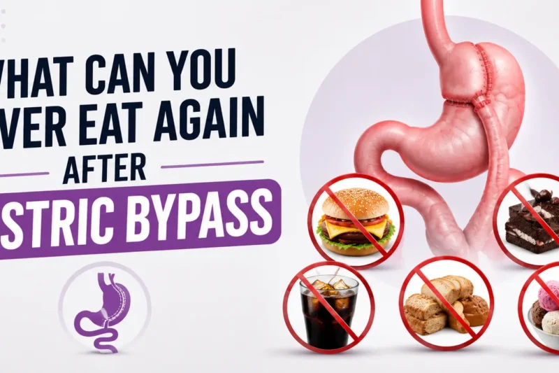 What Can You Never Eat Again After Gastric Bypass?